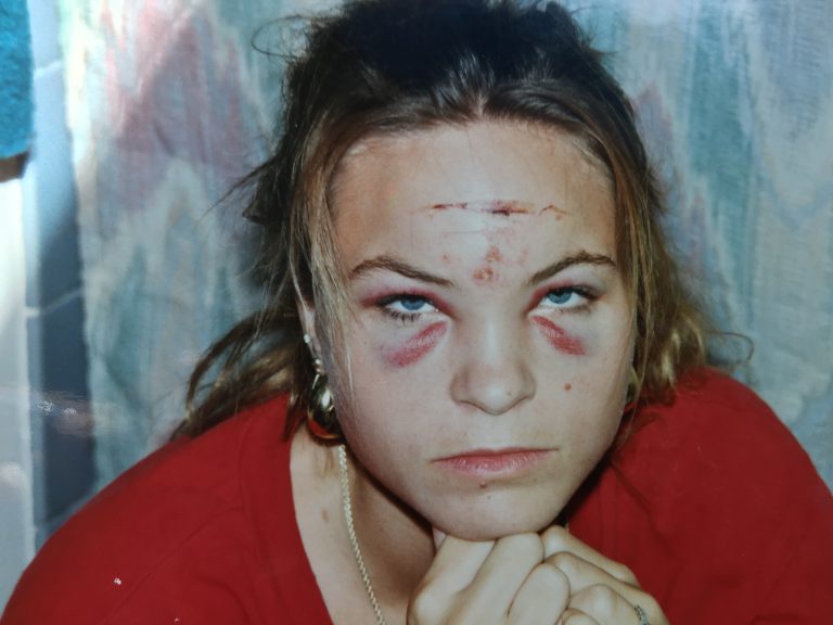 I was slipped a date rape drug
